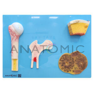 Estrutura Óssea, em Placa - Tgd-0155-e