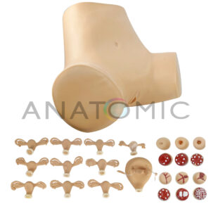 Simulador Ginecológico com Útero Saudável e Patológicostgd-4024