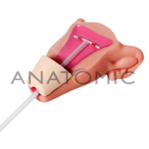 Simulador para Colocação do Diu - Tgd-0353-d