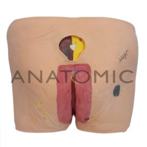 Modelo de Lesão por Pressão - Tzj-4009-c