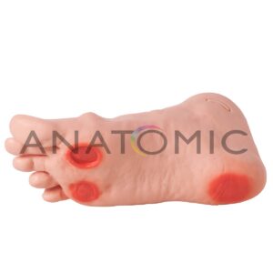 Pé Diabético - Tzj-0330-d