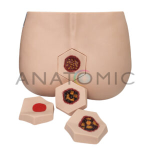 Simulador de Estágios de Lesões por Pressão - Tzj-4009-u